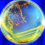 ¿Cuál es la bacteria más fuerte del mundo?
