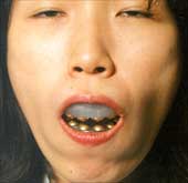chindogu-12-protector-dientes-dental
