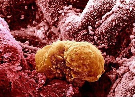 cuerpo-humano-microscopio-embrion-6-dias