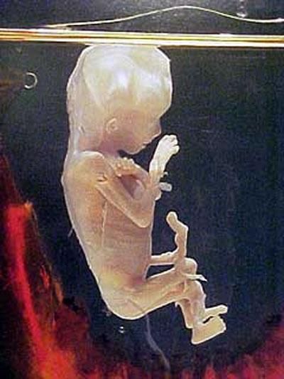 atrocidades-del-formol-feto