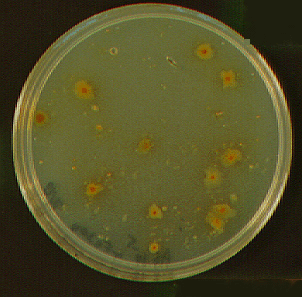 colonia Thiobacillus ferrooxidans