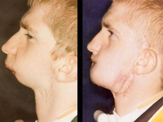 alan doherty jaw before after