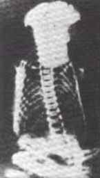 radiografia rayos x momia montanas pedro