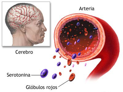 serotonina sangre cerebro arterias