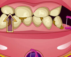 Juego en la consulta del dentista juego-consulta-dentista